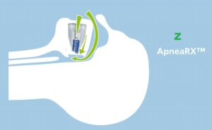 Aparat przeciw chrapaniu apneaRX